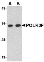 POLR3F Antibody in Western Blot (WB)