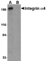 ITGA4 Antibody in Western Blot (WB)