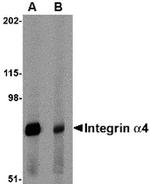 ITGA4 Antibody in Western Blot (WB)