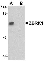 ZNF350 Antibody in Western Blot (WB)