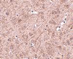 Lass6 Antibody in Immunohistochemistry (IHC)