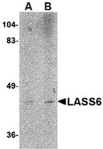 Lass6 Antibody in Western Blot (WB)