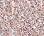 KLRA1 Antibody in Immunohistochemistry (IHC)