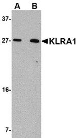 KLRA1 Antibody in Western Blot (WB)