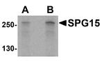 ZFYVE26 Antibody in Western Blot (WB)