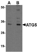 ATG5 Antibody in Western Blot (WB)