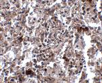 KCTD15 Antibody in Immunohistochemistry (IHC)