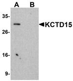 KCTD15 Antibody in Western Blot (WB)