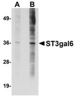 ST3GAL6 Antibody in Western Blot (WB)