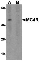 MC4R Antibody in Western Blot (WB)