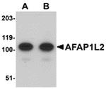 AFAP1L2 Antibody in Western Blot (WB)