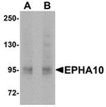 EphA10 Antibody in Western Blot (WB)