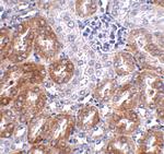 LIAR Antibody in Immunohistochemistry (IHC)