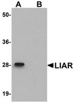 LIAR Antibody in Western Blot (WB)