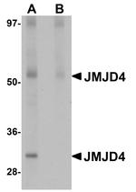 JMJD4 Antibody in Western Blot (WB)