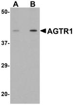 AGTR1 Antibody in Western Blot (WB)