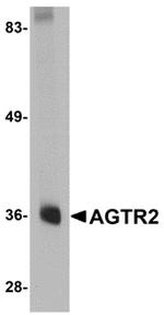 AGTR2 Antibody in Western Blot (WB)