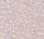 FRMPD2 Antibody in Immunohistochemistry (IHC)