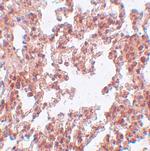 SRPX2 Antibody in Immunohistochemistry (IHC)