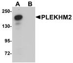 PLEKHM2 Antibody in Western Blot (WB)