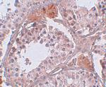 CLPH Antibody in Immunohistochemistry (IHC)