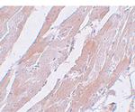 CCDC47 Antibody in Immunohistochemistry (IHC)