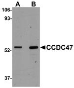 CCDC47 Antibody in Western Blot (WB)