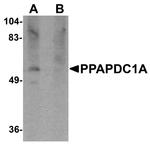 PPAPDC1A Antibody in Western Blot (WB)