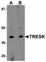 KCNK18 Antibody in Western Blot (WB)