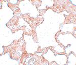 VLK Antibody in Immunohistochemistry (IHC)