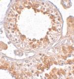 ESX1 Antibody in Immunohistochemistry (IHC)