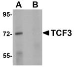 TCF3 Antibody in Western Blot (WB)