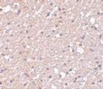 TMEM184A Antibody in Immunohistochemistry (IHC)
