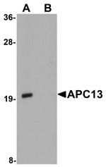 APC13 Antibody in Western Blot (WB)