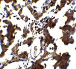 ZEB1 Antibody in Immunohistochemistry (IHC)