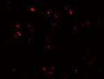 ZEB2 Antibody in Immunocytochemistry (ICC/IF)