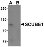 SCUBE1 Antibody in Western Blot (WB)