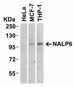 NLRP6 Antibody in Western Blot (WB)