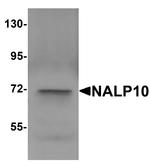 NALP10 Antibody in Western Blot (WB)