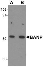 BANP Antibody in Western Blot (WB)