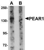 PEAR1 Antibody in Western Blot (WB)