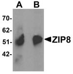 SLC39A8 Antibody in Western Blot (WB)