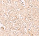 FBXL16 Antibody in Immunohistochemistry (IHC)