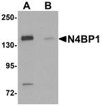 N4BP1 Antibody in Western Blot (WB)