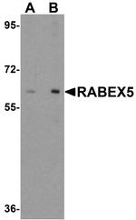 Rabex-5 Antibody in Western Blot (WB)