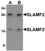 CD48 Antibody in Western Blot (WB)