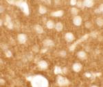 TMEM88 Antibody in Immunohistochemistry (IHC)