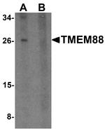 TMEM88 Antibody in Western Blot (WB)