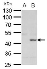 XRCC3 Antibody in Western Blot (WB)