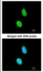 ERCC8 Antibody in Immunocytochemistry (ICC/IF)